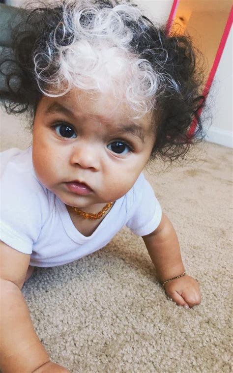 Greene of drgreene.com points out that there are conditions that can make a child's hair go gray, including neurofibromatosis, also known as recklinghausen disease 3. Doctors Finally Realize Why Baby Was Born With Head Full ...