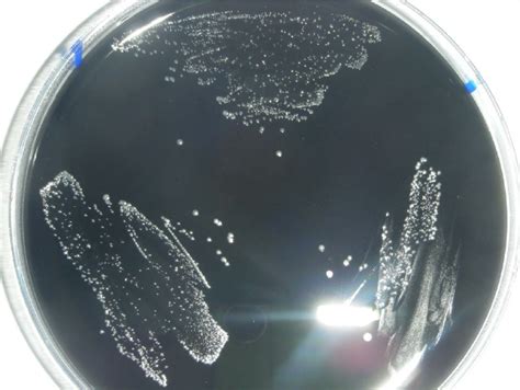 Campylobacter Ccda Agar Microbiologia Italia