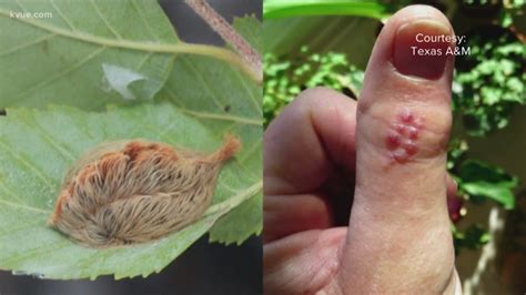 Cute And Fluffy Asp Caterpillars Pack Painful Sting