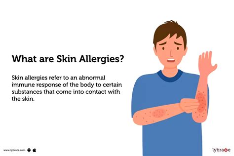Skin Allergies Types Symptoms Causes And Diagnosis