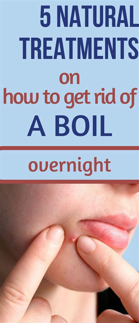 5 Natural Treatments On How To Get Rid Of A Boil Overnight How To Get
