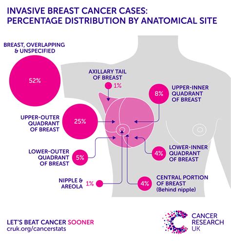 Womens Health Breast And Other Female Cancers Internet Resources