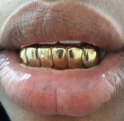 Real mike gold teeth provides gold teeth diamond cuts, gold teeth cleaning and gold teeth fixing to the miami, fl area. Gold Grillz Miami BLACK FRIDAY DEALS are now! Early Come Fast Serve Call/Text anytime 305.989 ...