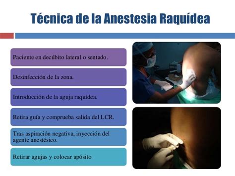 Introduccion A La Anestesia Tipos De Anestesia Images