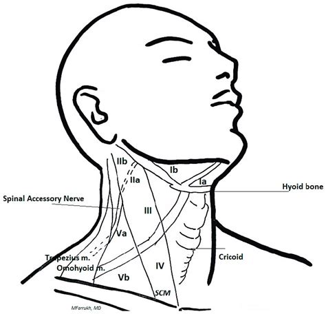 Lymph Node Levels Of The Neck And Landmarks For Lymphadenectomy