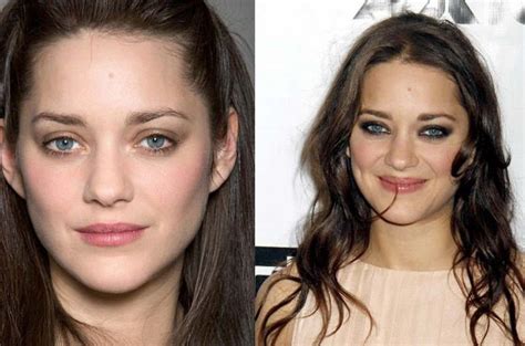 Marion Cotillard Before And After Plastic Surgery 29 Celebrity