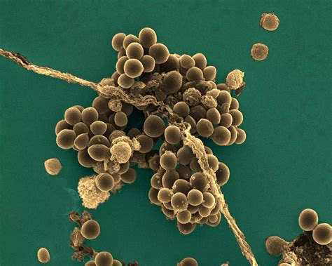 Staphylococcus Aureus A New Mechanism Involved In Virulence And Antibiotic