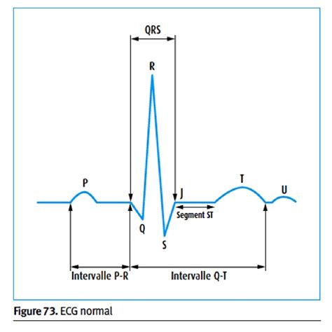 An interval may be described as horizontal, linear, or melodic if it refers to successively sounding tones. Formation à « l'ECG de A à Z » par Pierre Taboulet