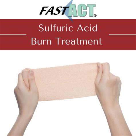 Sulphuric Acid Burn First Aid Fast Act