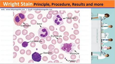 Wright Stain Principle Procedure Results And More Lab Tests Guide
