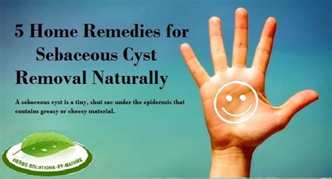 5 Home Remedies For Sebaceous Cyst Removal Naturally Sebaceous Cyst