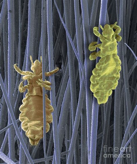 Head Lice Photograph By Steve Gschmeissnerscience Photo Library Pixels