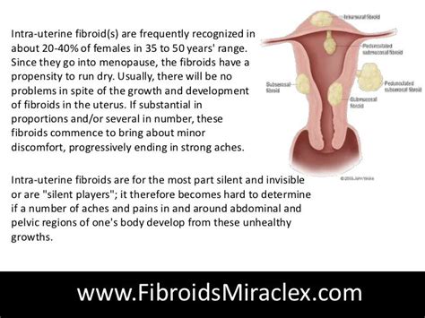Fibroids Symptoms