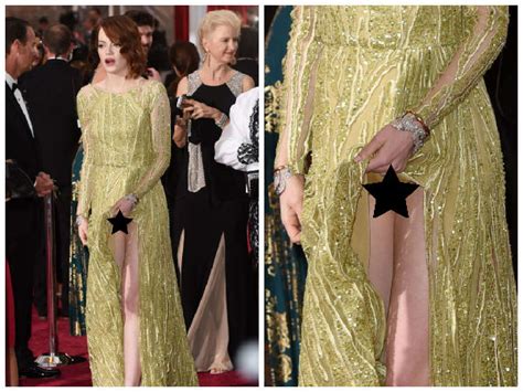 Emma Stone Oscars Behati Prinsloo Wardrobe Malfunction Oscars Party Emma Stone Wardrobe