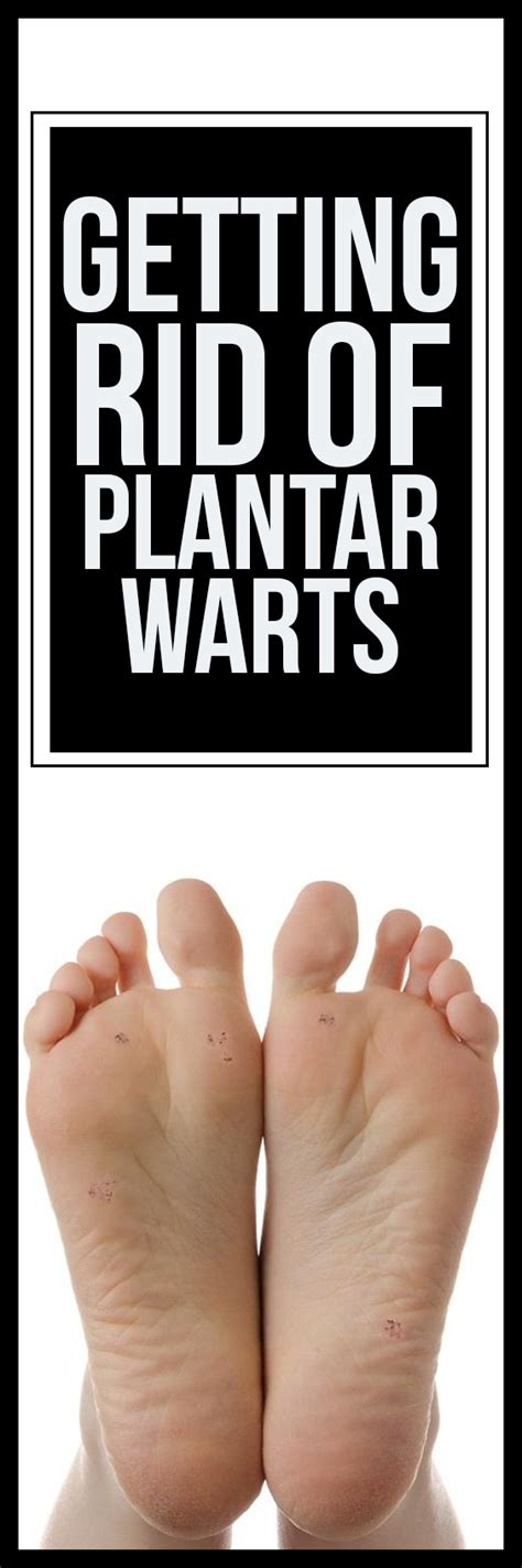 Getting Rid Of Plantar Warts
