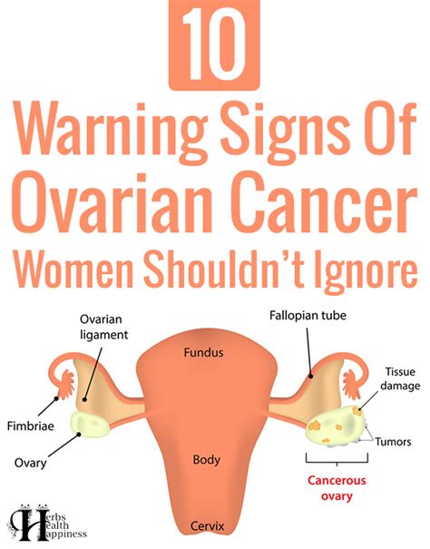 Herbs Health And Happiness 10 Warning Signs Of Ovarian Cancer Women
