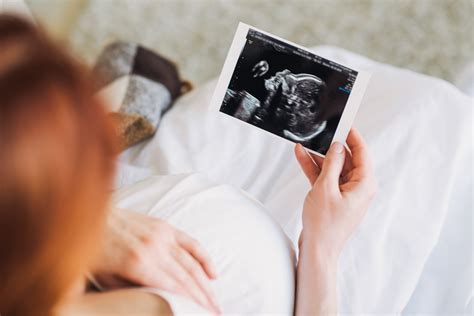 Schon sehr früh besteht die möglichkeit einen 3d ultraschall mit einer vaginalen 3d ultraschallsonde diese zeit ist der optimale zeitpunkt für ganzkörperaufnahmen. Feindiagnostik in der 22. SSW - Der Organultraschall ...