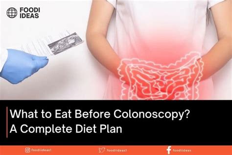 What To Eat Before Colonoscopy A Complete Diet Plan 2023