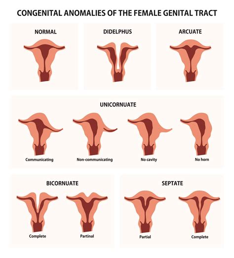 Разновидности женских органов фото Большое количество фотоматериала