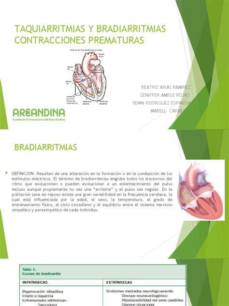 Taquiarritmias Y Bradiarritmias Pdf Corazón Electrocardiografia