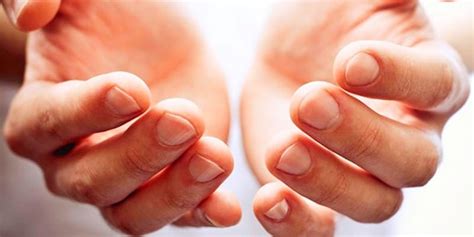Komplikasi kudis sendiri dapat dibagi menjadi beberapa jenis, yaitu: Kudis: Scabies, Bagaimana Cara Mengobati dan Mencegahnya ...