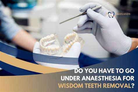 Do You Have To Go Under Anaesthesia For Wisdom Teeth Removal