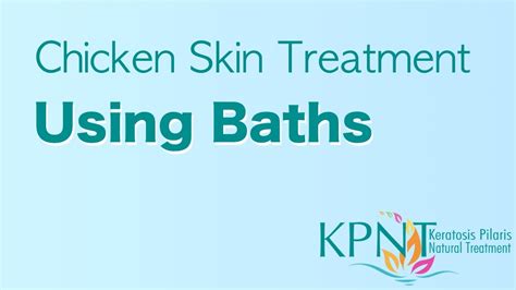 Chicken Skin Treatment Using Baths Video Youtube