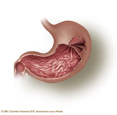 Layers Of Stomach Archives Medical Illustrations And Animations By
