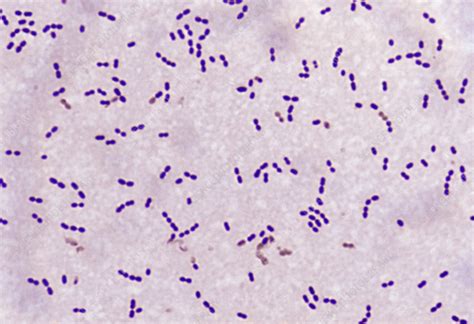 Streptococcus Bacteria Stock Image B2360145 Science Photo Library
