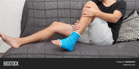 Bone Fracture Foot Leg Image And Photo Free Trial Bigstock