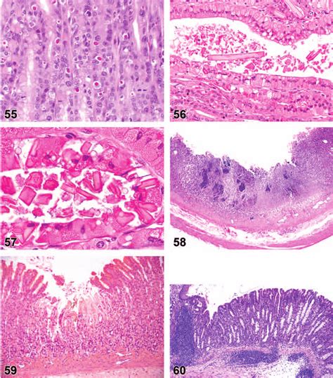 Rat Glandular Stomach Eosinophilic Globules Figure 56 Mouse