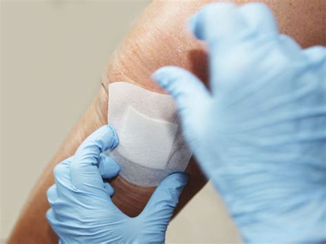Materialeigenschaften zerstört oder stoffe in die wunde frei gesetzt werden können. Aseptische Wunde - CNE.online - Certified Nursing ...
