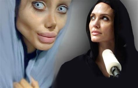 After Surgeons She Wanted To Look Like Angelina Jolie News
