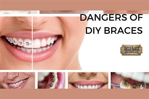 Includes home improvement projects, home repair, kitchen remodeling, plumbing, electrical, painting, real estate, and decorating. The Dangers Of "Do It Yourself" Braces