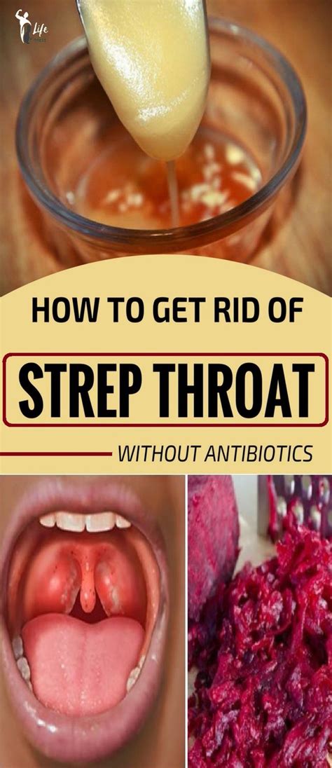 How To Get Rid Of Strep Throat Without Antibiotics Strep Throat