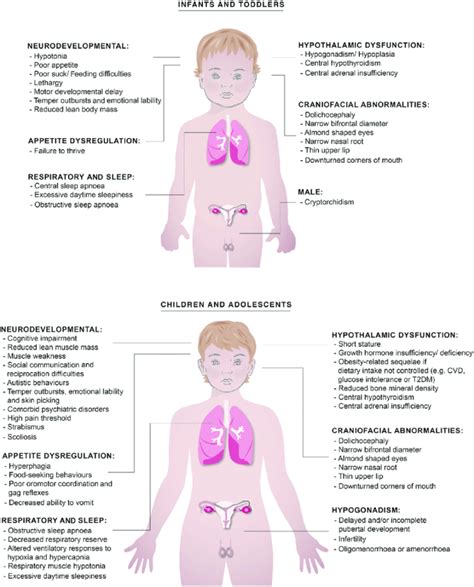 what is prader willi syndrome anthoshouse