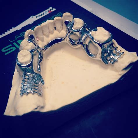 Châssis métallique (stellite) dentaire | Laboratoire Simon N