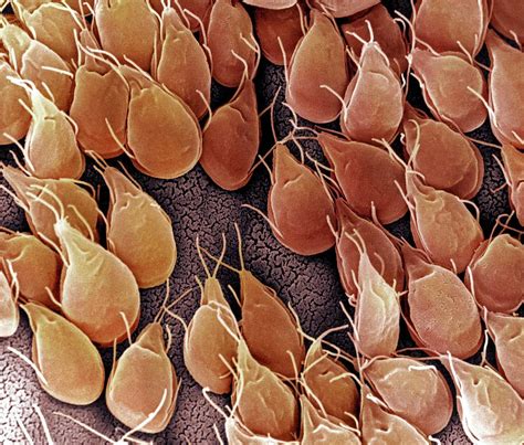 Giardia Lamblia Protozoan Photograph By Ami Images Science Photo Library Fine Art America