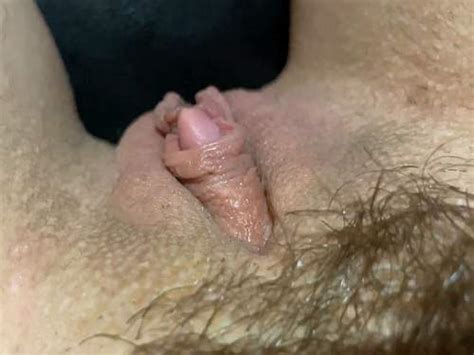 Download Free Hairy Huge Clitoris Porn Videos Porno Fisting