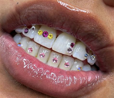 Pin By Julianna Green On S M I L E In Tooth Gem Pink Gem