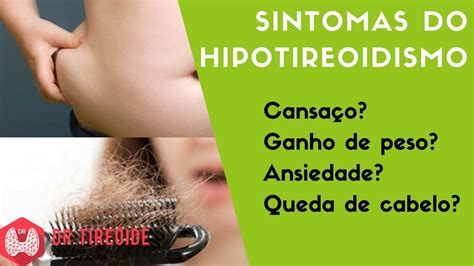 Sintomas Do Hipotireoidismo Dr J Natas Catunda Youtube