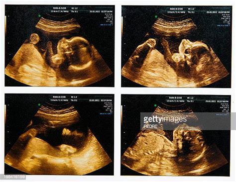 Baby In Womb Photos And Premium High Res Pictures Getty Images
