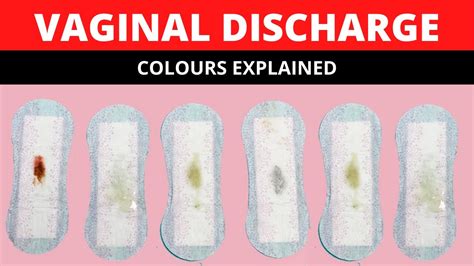 Vaginal Discharge Colours Is My Discharge Normalthrush Bacterial
