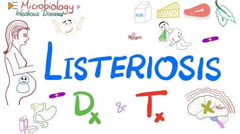 Listeria Monocytogenes Listeriosis Diagnosis And Treatment