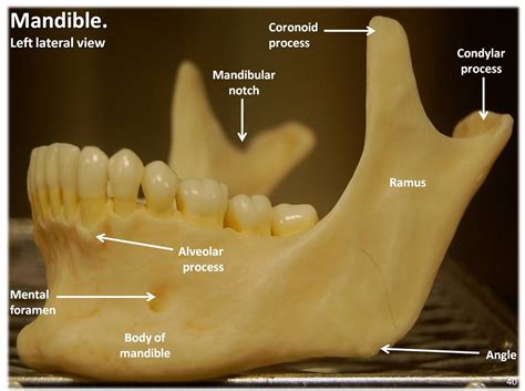 Mandible Lateral View With Labels Axial Skeleton Visual Atlas Page