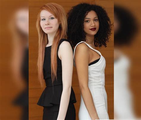 20 years after their birth captivated the world the aylmer twins are all grown up biracial