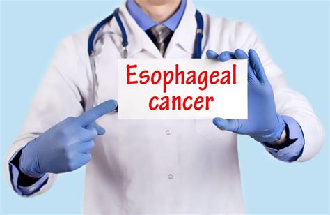 Common Symptoms Of Esophageal Cancer RocketFacts