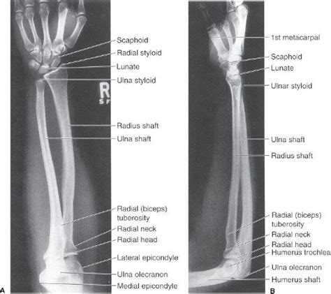 6 Musculoskeletal System Radiology Key