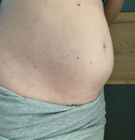 Keine rutschigen, flauschigen decken als unterlage Bauch 6. Monat 😊 | Forum Schwangerschaft - urbia.de