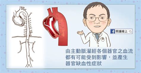 如果動脈內出現鈣化，就會得到一個鈣化指數，醫生可依此來判斷動脈鈣化的嚴重程度，從而評估病人出現冠心病的機率，及早規劃進一步的預防方案。 ⇓延伸閱讀，即click了解更多心血管健康資訊⇓ ⇒ 隱型殺手高血壓 無分年齡無症狀易中招. 江丙坤主動脈剝離昏迷》高血壓患者最要注意!醫師提醒：主動脈剝離的7大要命症狀 - 照護線上-良醫健康網